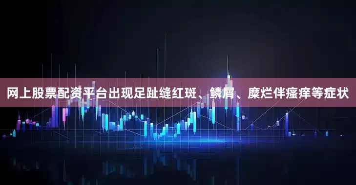 网上股票配资平台出现足趾缝红斑、鳞屑、糜烂伴瘙痒等症状